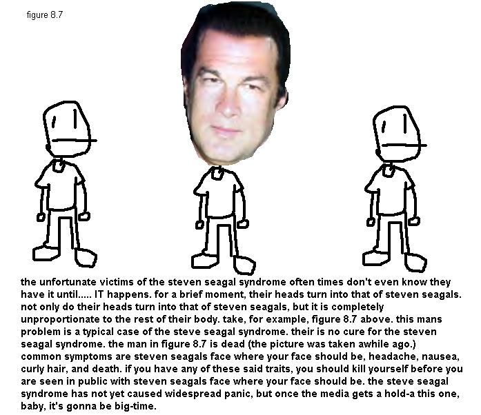 steven seagal syndrome